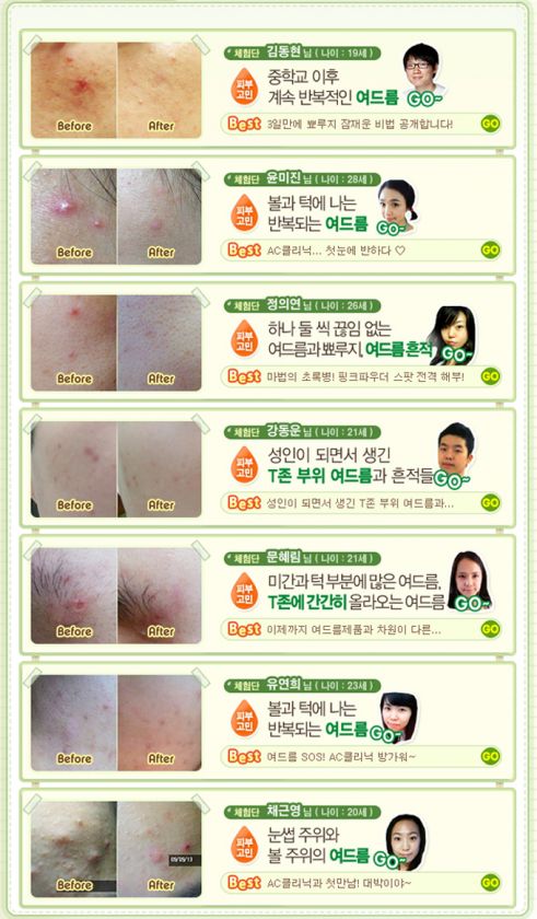   _clinic_toner/etudehouse_etude_house_ac_clinic_toner_description2